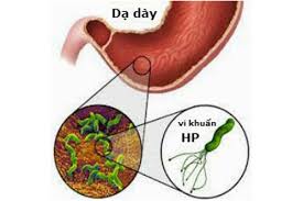 image-Hpylori
