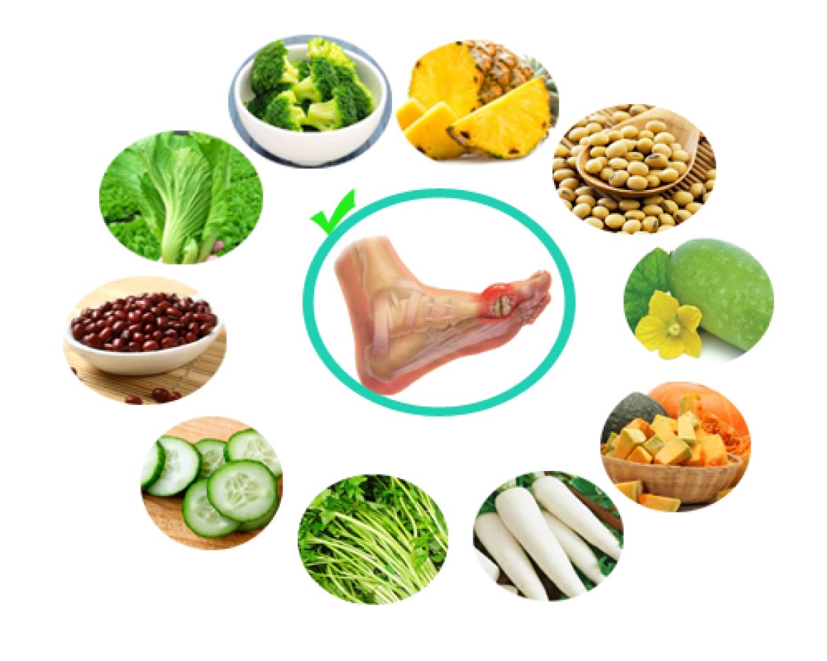 Nguyên tắc xây dựng chế độ ăn trong bệnh Gout (Gút)